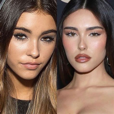 madison beer plastic sugery|Madison Beer Defends Herself Over Claims About。